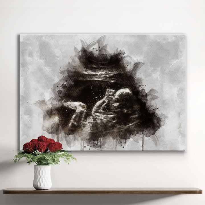 Custom Baby Ultrasound Watercolor Portrait